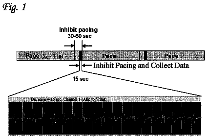 Drawing from US 8,639,323 B2
