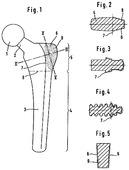 Drawing sheet 1 of US 8,641,772 B2