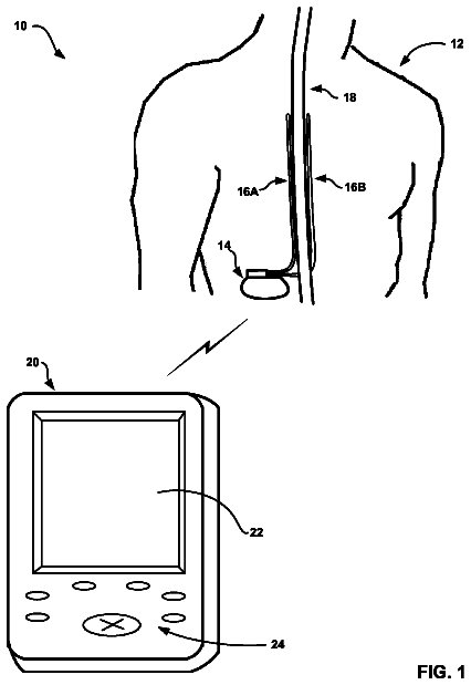 Drawing from US 8,649,872 B2
