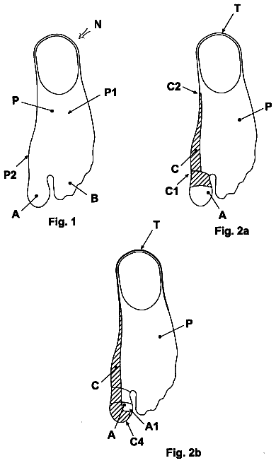 Drawing from US 8,663,178 B2