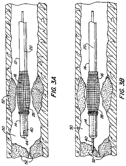 Drawing sheet 4 of US 8,668,654 B1