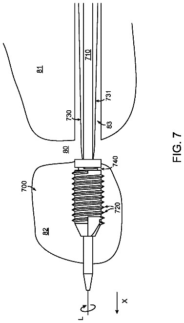 Drawing sheet 6 of US 8,679,168 B2