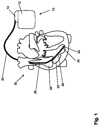 Drawing from US 8,682,427 B2