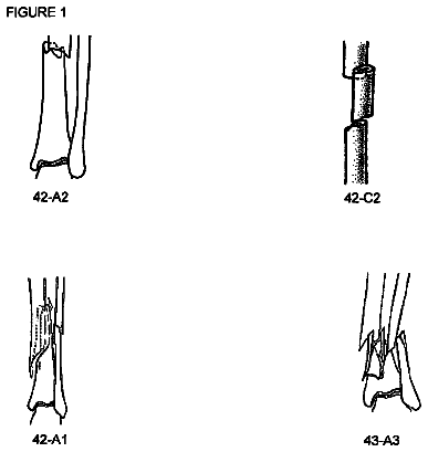 Drawing from US 8,687,865 B2