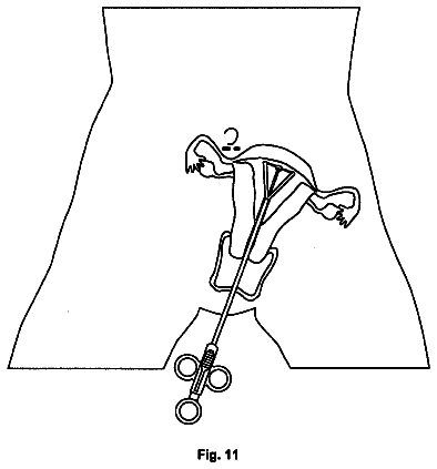 Drawing sheet 8 of US 8,690,892 B2