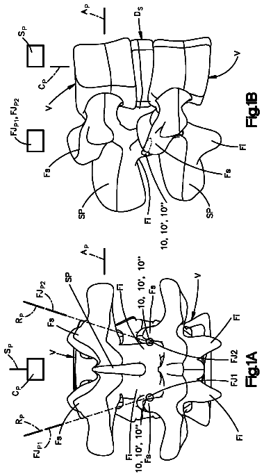Drawing from US 8,696,708 B2