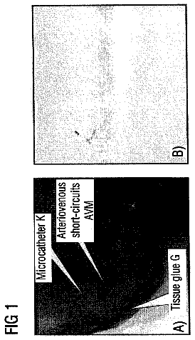 Drawing from US 8,712,131 B2