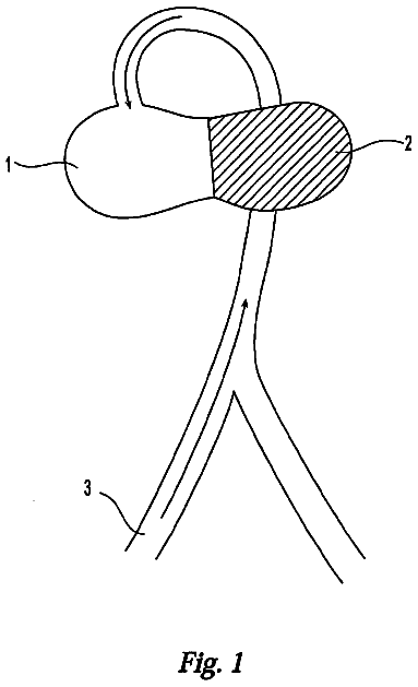 Drawing from US 8,715,156 B2