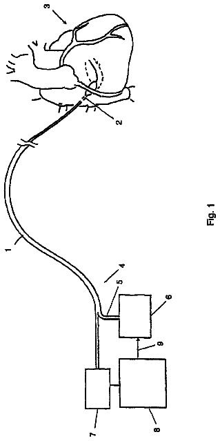 Drawing sheet 1 of US 8,715,196 B2