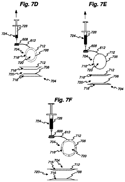 Drawing sheet 8 of US 8,715,218 B2