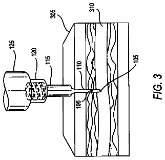 Drawing sheet 4 of US 8,715,223 B2