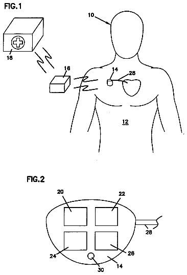 Drawing from US 8,718,772 B2