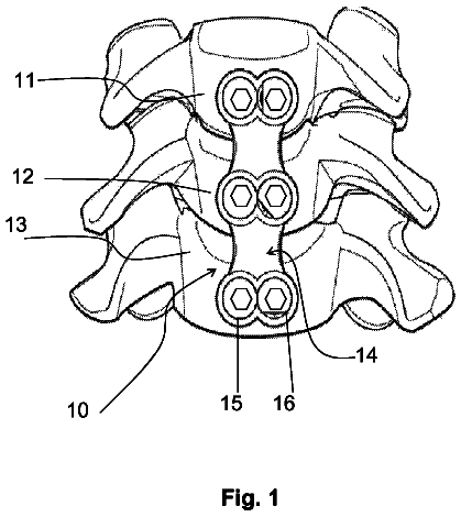 Drawing sheet 1 of US 8,734,493 B2