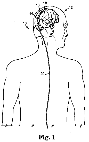 Drawing sheet 1 of US 8,740,833 B2