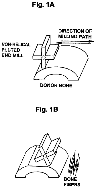 Drawing sheet 1 of US 8,740,987 B2