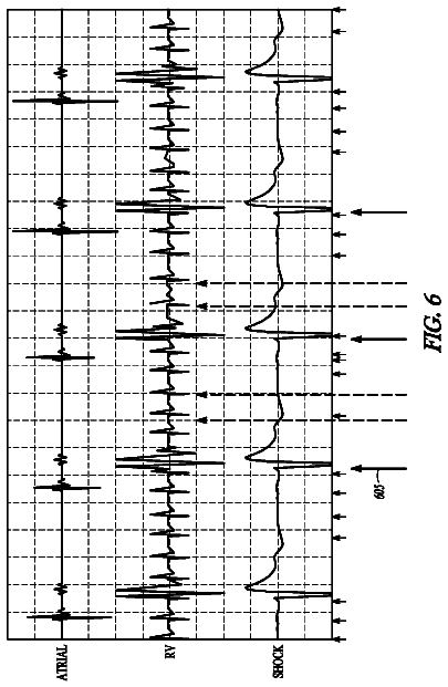 Drawing sheet 6 of US 8,744,556 B2