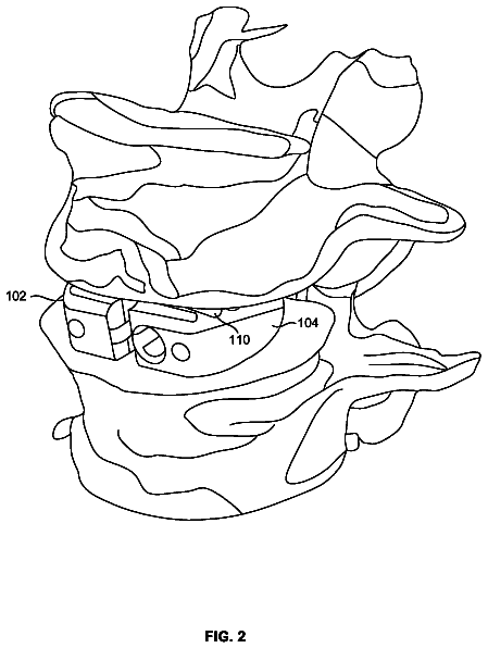 Drawing sheet 3 of US 8,747,473 B2