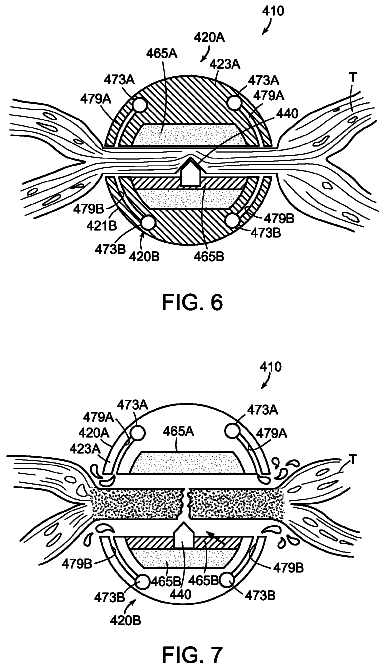 Drawing sheet 7 of US 8,753,338 B2