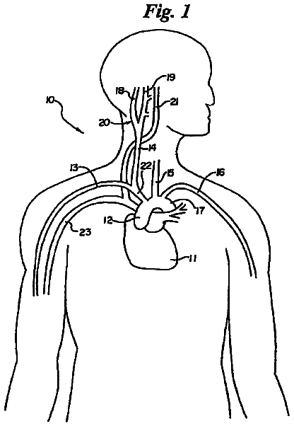 Drawing sheet 1 of US 8,755,907 B2