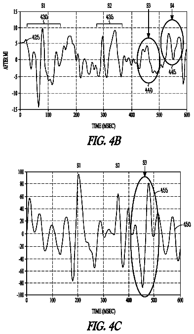 Drawing sheet 4 of US 8,758,260 B2