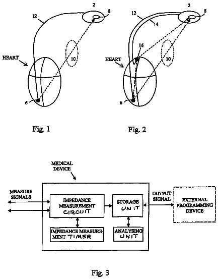 Drawing from US 8,761,871 B2
