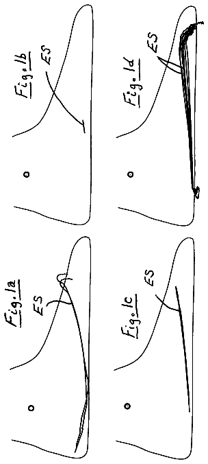 Drawing from US 8,764,850 B2