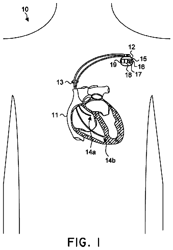 Drawing from US 8,768,443 B2