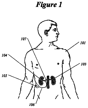 Drawing from US 8,771,252 B2
