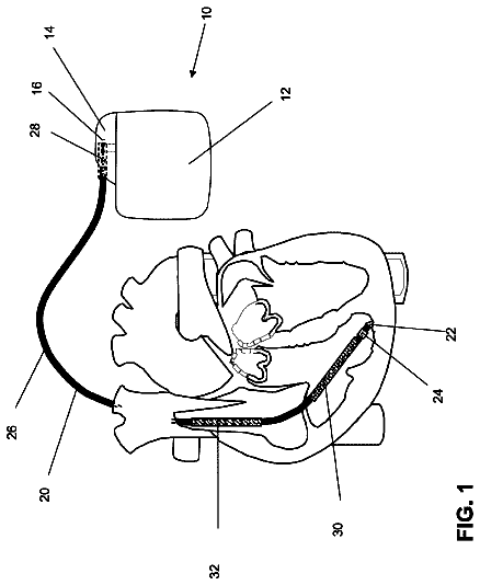 Drawing from US 8,774,934 B2