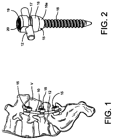 Drawing from US 8,777,954 B2