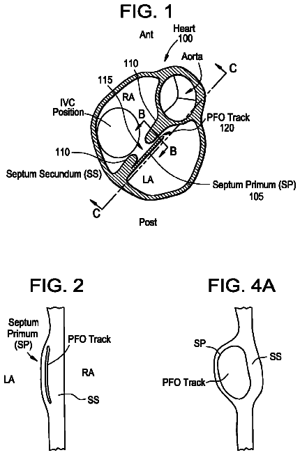 Drawing from US 8,777,984 B2