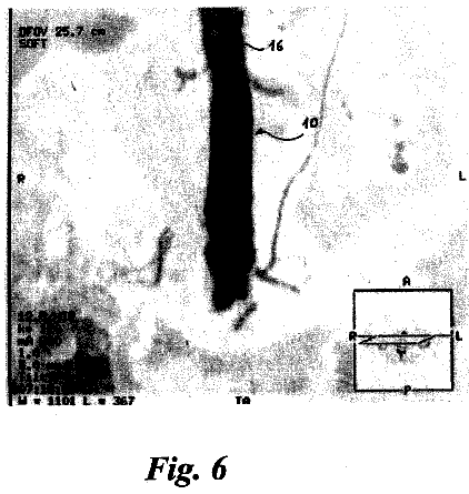 Drawing sheet 4 of US 8,778,015 B2