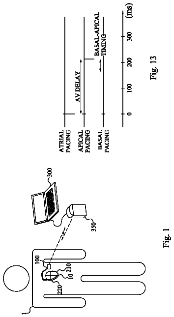 Drawing from US 8,781,579 B2