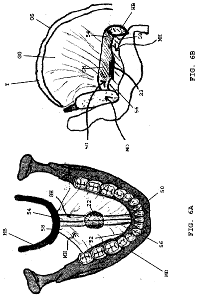 Drawing sheet 5 of US 8,783,258 B2
