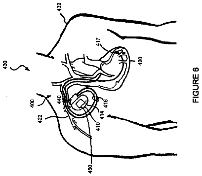 Drawing sheet 6 of US 8,785,046 B2