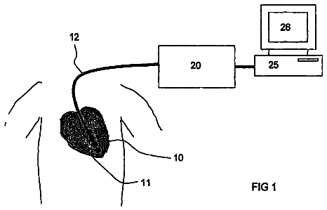 Drawing from US 8,788,029 B2