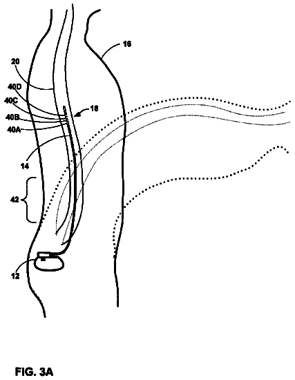 Drawing sheet 3 of US 8,788,055 B2