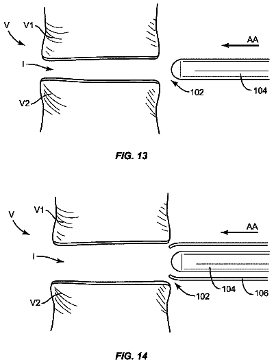 Drawing sheet 6 of US 8,795,368 B2