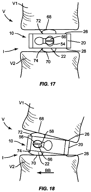 Drawing sheet 8 of US 8,795,368 B2