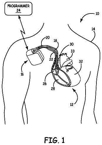 Drawing from US 8,798,751 B2