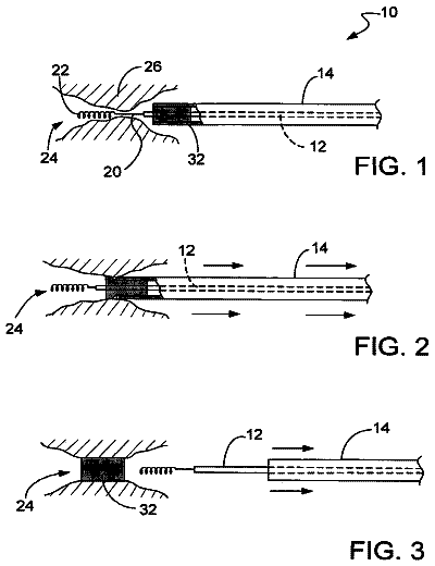 Drawing from US 9,737,427 B2