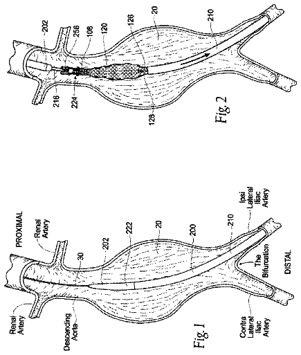 Drawing from US 9,744,021 B2