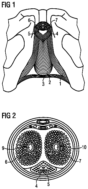 Drawing from US 9,750,874 B2