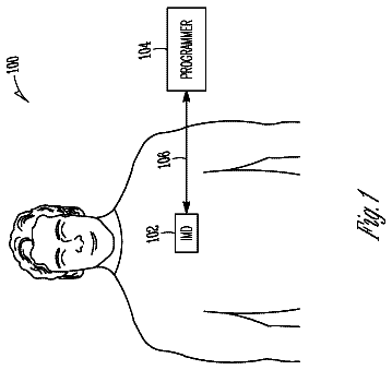Drawing from US 9,750,938 B2