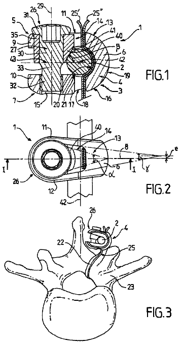 Drawing from US 9,775,651 B2