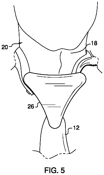 Drawing sheet 3 of US 9,781,961 B2