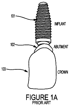 Drawing sheet 1 of US 9,782,240 B2