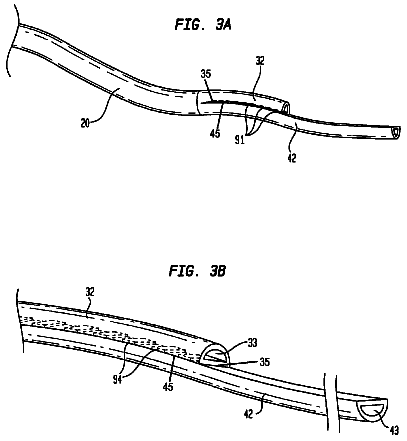 Drawing sheet 6 of US 9,782,535 B2