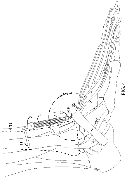 Drawing sheet 4 of US 9,788,936 B2