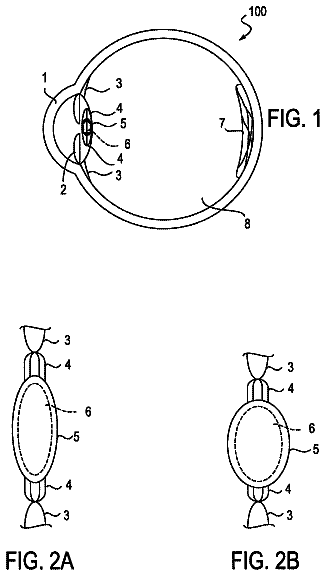 Drawing sheet 1 of US 9,795,473 B2